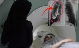 Hastaya “Göğsünde canlı böcek var” dendi, gerçek çok başka çıktı