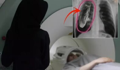 Hastaya “Göğsünde canlı böcek var” dendi, gerçek çok başka çıktı