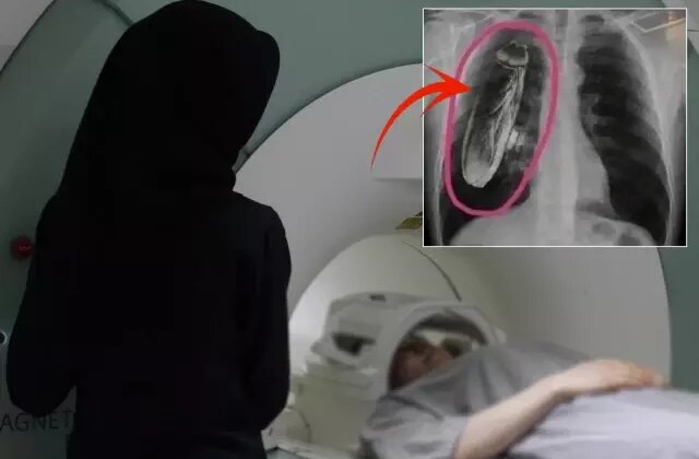 Hastaya “Göğsünde canlı böcek var” dendi, gerçek çok başka çıktı