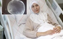 Kazakistanlı kadının karnından yaklaşık 45 santimetrelik tümör çıkarıldı