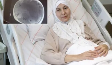 Kazakistanlı kadının karnından yaklaşık 45 santimetrelik tümör çıkarıldı