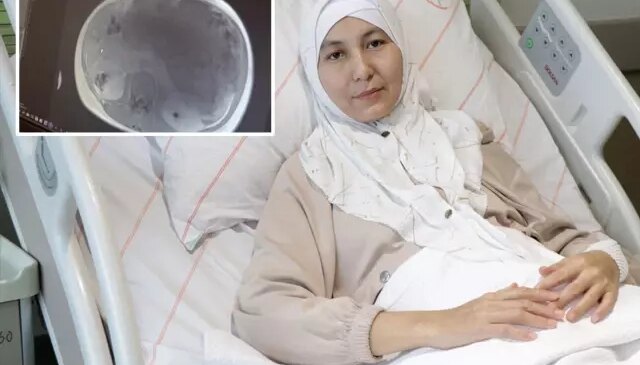 Kazakistanlı kadının karnından yaklaşık 45 santimetrelik tümör çıkarıldı