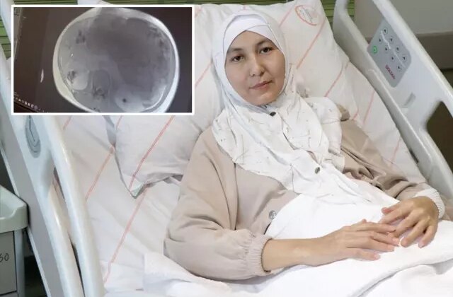 Kazakistanlı kadının karnından yaklaşık 45 santimetrelik tümör çıkarıldı