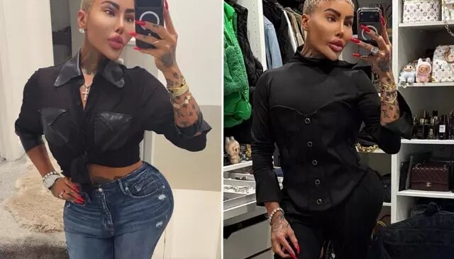 Kim Kardashian’a benzemek için estetik yaptıran fenomen hayatını kaybetti: 2 kişi cinayetten tutuklandı