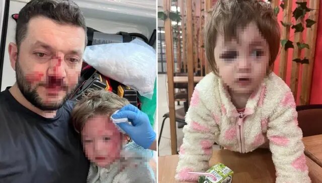 Komşuların gürültü kavgasında 14 aylık bebeğin kafatası çatladı