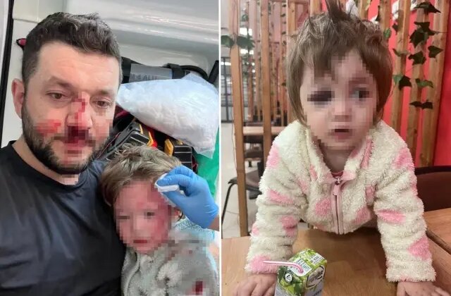 Komşuların gürültü kavgasında 14 aylık bebeğin kafatası çatladı