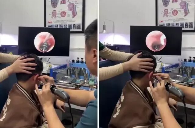 Küçük çocuğun kulağından çıkana, doktorlar bile şaştı kaldı