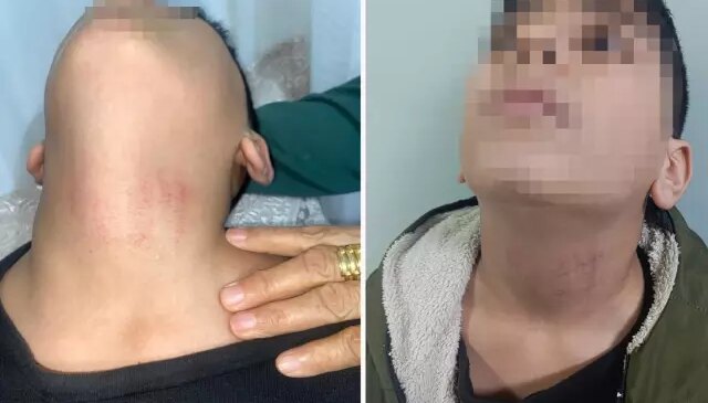 Küçükçekmece’de kadın memurun 10 yaşındaki öğrenciyi okulda darbettiği iddiası