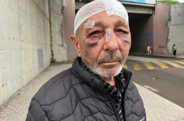 Çakmak istediler verdi, sonrasında bu hale geldi