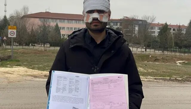 Rehber öğretmen kaynar çayla fizik öğretmenini haşladı