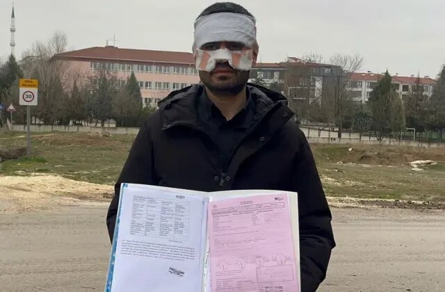 Rehber öğretmen kaynar çayla fizik öğretmenini haşladı