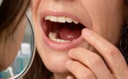 Sabah uyandığında dişleri yoktu! Doktorları bile şaşırtan gerçek hastaneye ortaya çıktı