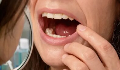 Sabah uyandığında dişleri yoktu! Doktorları bile şaşırtan gerçek hastaneye ortaya çıktı