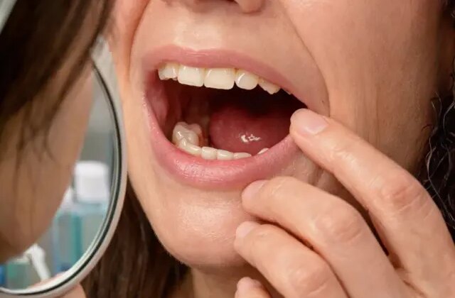 Sabah uyandığında dişleri yoktu! Doktorları bile şaşırtan gerçek hastaneye ortaya çıktı