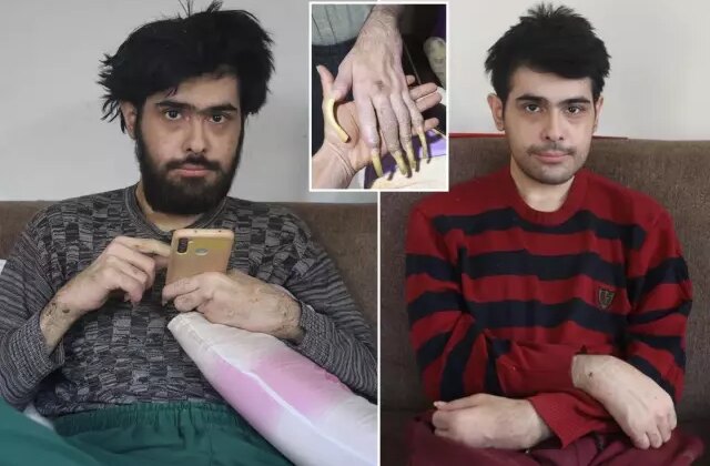 Telefon bağımlısı gençten ailelere tavsiye: Küçükken çocuklara telefon vermeyin