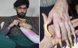 Türkiye’nin konuştuğu Barış’ın yeni işini ve son halini görenler şaşıp kalıyor