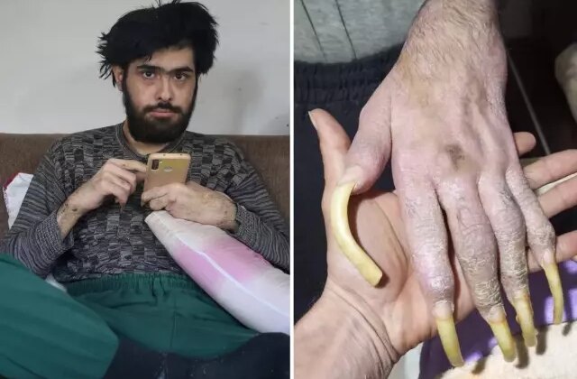 Türkiye’nin konuştuğu Barış’ın yeni işini ve son halini görenler şaşıp kalıyor