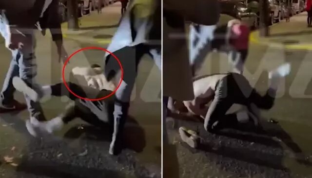 Olay görüntü! Ünlü oyuncu çıkan kavgada ağır şekilde darbedildi