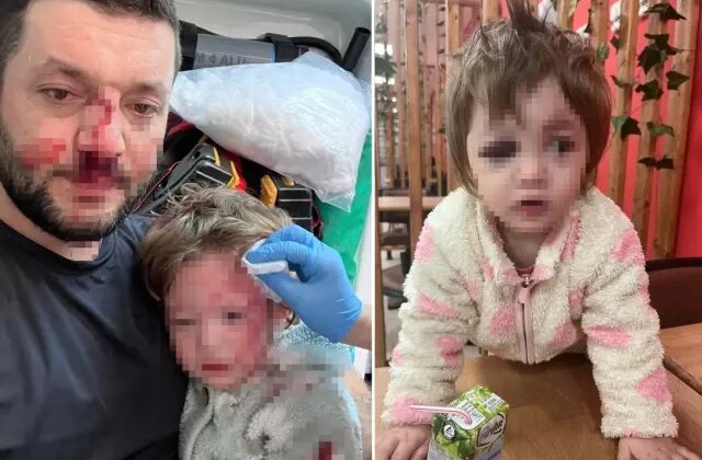 Yalova’da 14 aylık bebeğin yaralandığı olayda pes dedirten savunma