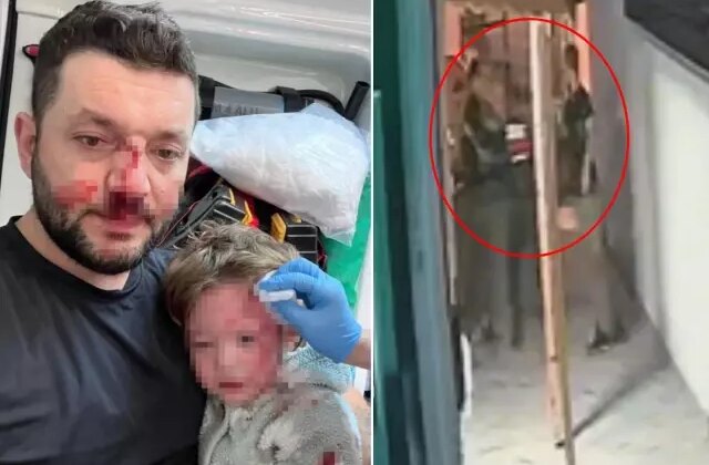 Yalova’da baba ile 14 aylık bebeğinin darbedildiği görüntüler ortaya çıktı