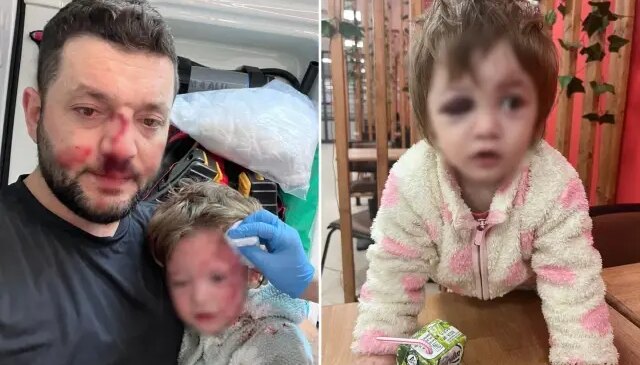 İşte 14 aylık İkra bebeği hastanelik edenlere istenen ceza! Skuter silah sayıldı