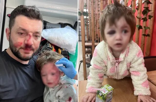 İşte 14 aylık İkra bebeği hastanelik edenlere istenen ceza! Skuter silah sayıldı