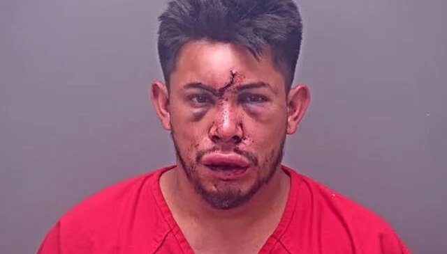 13 yaşındaki çocuk, evdeki olayı görünce babasını bu hale getirdi