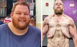 163 kilo verdi ama çilesi bitmedi