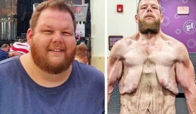 163 kilo verdi ama çilesi bitmedi