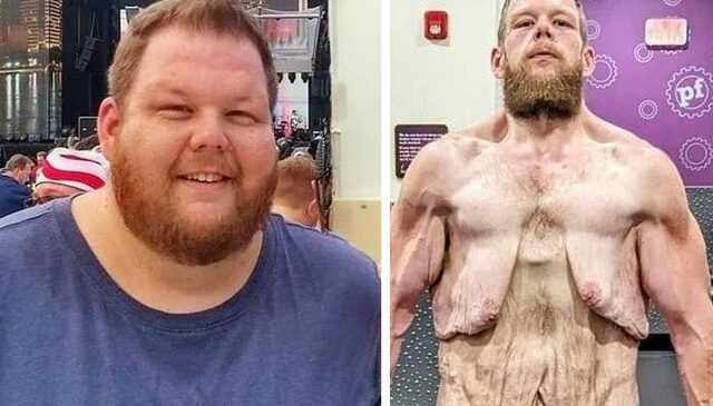 163 kilo verdi ama çilesi bitmedi