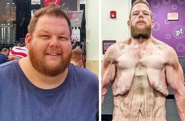 163 kilo verdi ama çilesi bitmedi