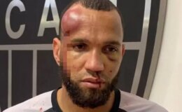 23 kırmızı kartın çıktığı futbol savaşında kaleci tanınmayacak hale geldi