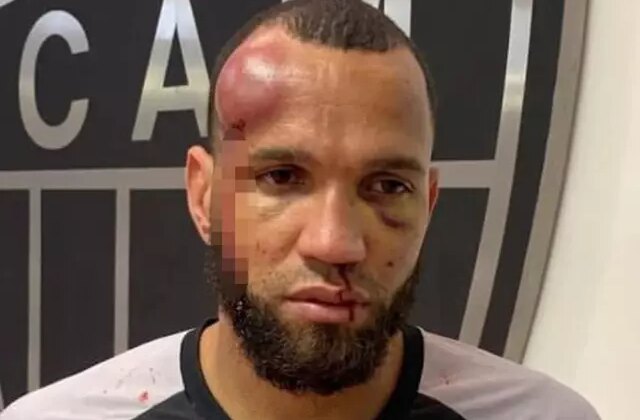 23 kırmızı kartın çıktığı futbol savaşında kaleci tanınmayacak hale geldi