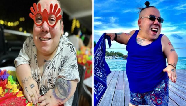 Cüce fenomen Alejo Little hayatını kaybetti, son paylaşımı yürek burktu