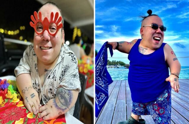 Cüce fenomen Alejo Little hayatını kaybetti, son paylaşımı yürek burktu