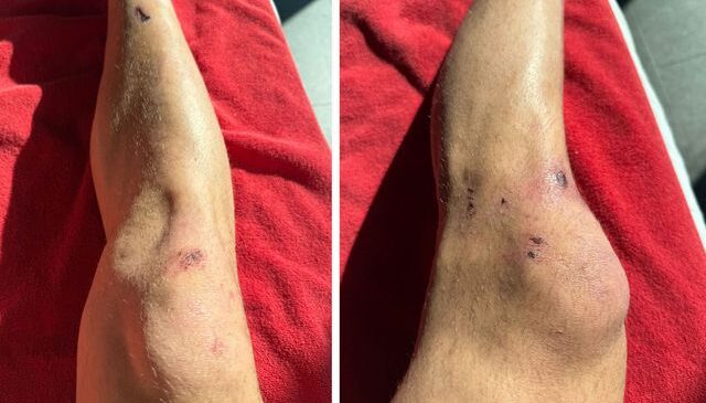 Dün gece yaşanan tarihi zaferin bedeli