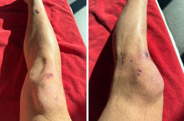 Dün gece yaşanan tarihi zaferin bedeli