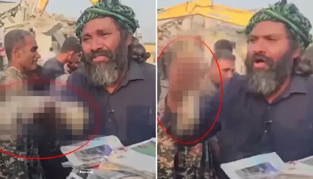 İran’da İlkokulda öldürülen kız çocuğunun kopan elini gösterip isyan etti: Dünya bu cinayeti görmeli