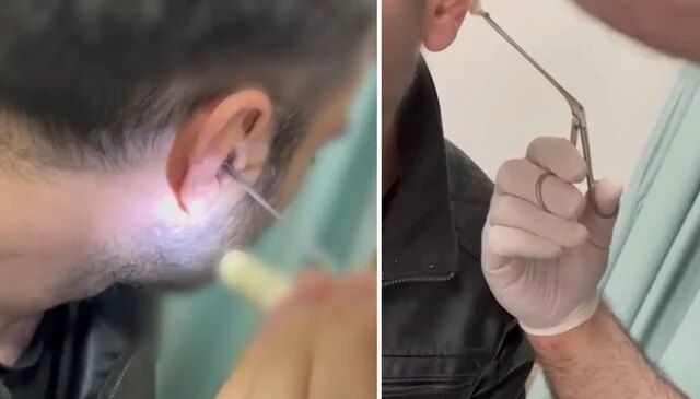 Kulağına gizlediği uyuşturucuyla yakalandı