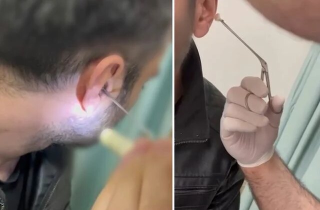 Kulağına gizlediği uyuşturucuyla yakalandı