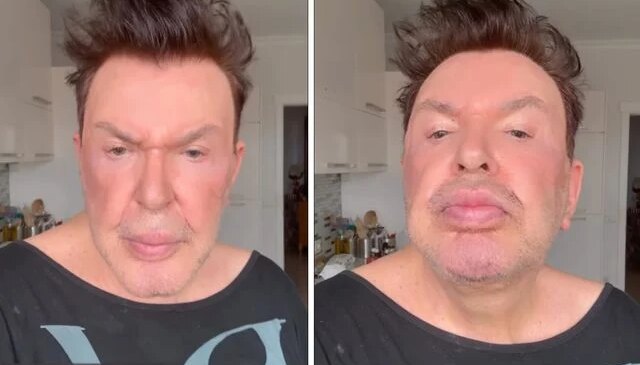 Kuşum Aydın estetik sonrası son halini paylaştı! Değişimi gündem oldu