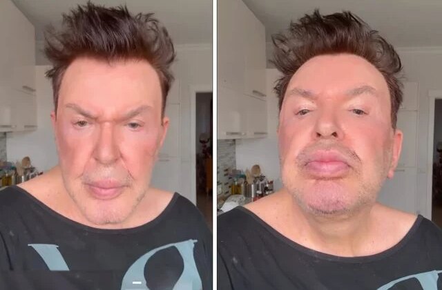 Kuşum Aydın estetik sonrası son halini paylaştı! Değişimi gündem oldu