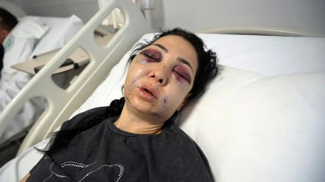 Oğlunun gözü önünde anneyi öldüresiye dövdüler: Küfür etmeyin dedik diye bu hale geldim