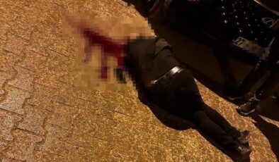 Sokakta yürürken tabanca ile başından vuruldu