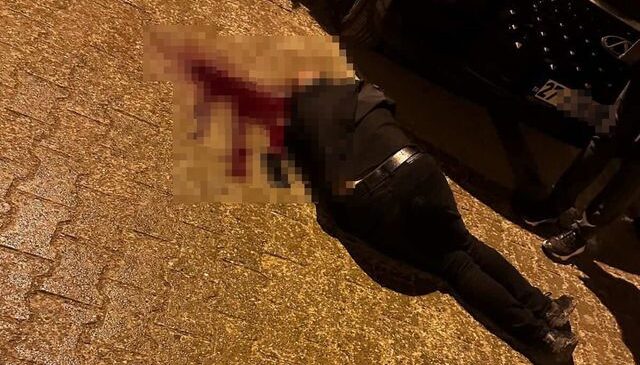 Sokakta yürürken tabanca ile başından vuruldu