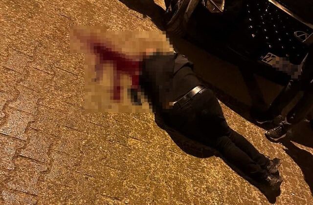 Sokakta yürürken tabanca ile başından vuruldu