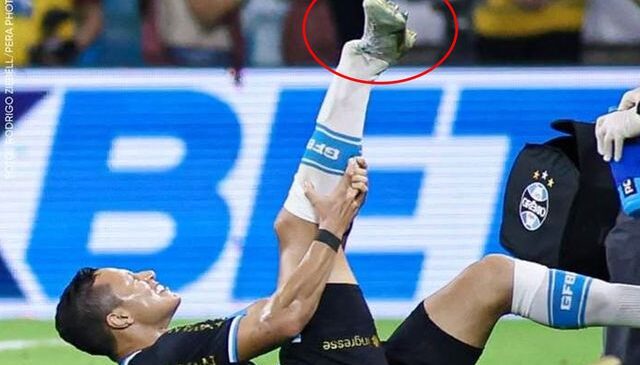 Süper Lig’in eski yıldızı ayağını kırdı! Acı içinde kaldı dakikarca kıvrandı