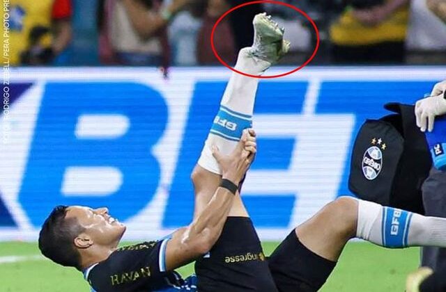 Süper Lig’in eski yıldızı ayağını kırdı! Acı içinde kaldı dakikarca kıvrandı