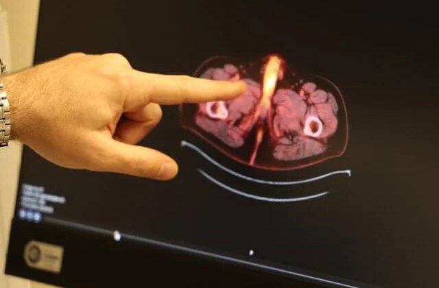 Tıp literatürüne giren son isim Diyarbakır’dan! Penisi alındı