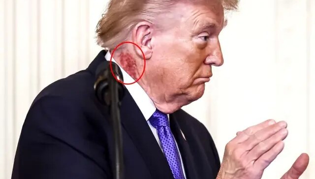 Savaş sürerken olay görüntü! Doktorundan jet açıklama geldi